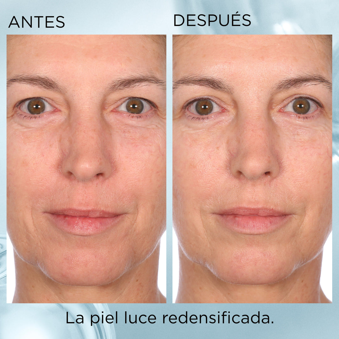 capsulas de ácido hialurónico