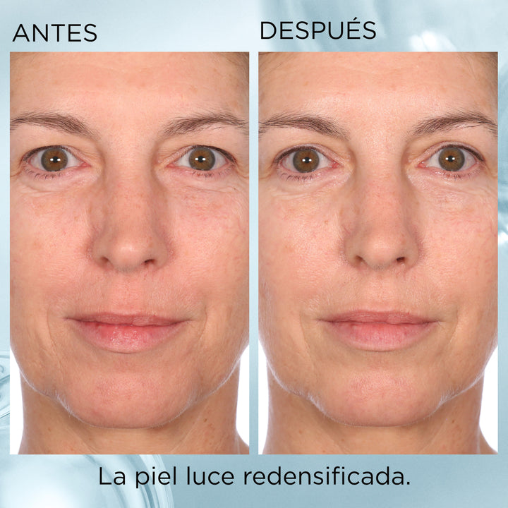 capsulas de ácido hialurónico